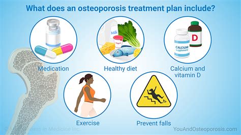 osteoporosis treatment falls church|Home .